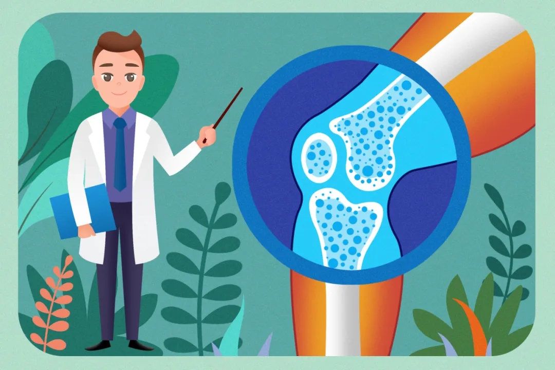 骨密度检查，两类人群可以不做 | 健康...